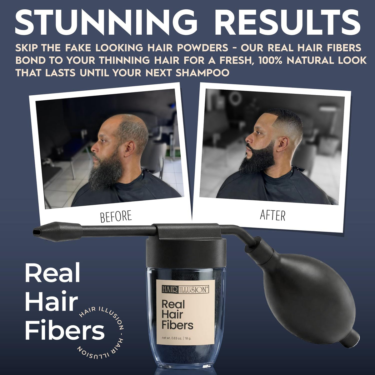 Hair Illusion Spray Applicator Removable Flat Tip designed to Spray Precise Hairline or Remove Tip For Round Sprayer And Wide Coverage (does not include hair fibers)