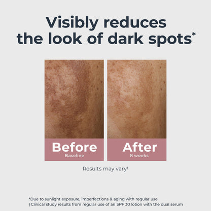 Eucerin Radiant Tone Dual Serum Dark Spot Corrector, Dark Spot Serum with Thiamidol