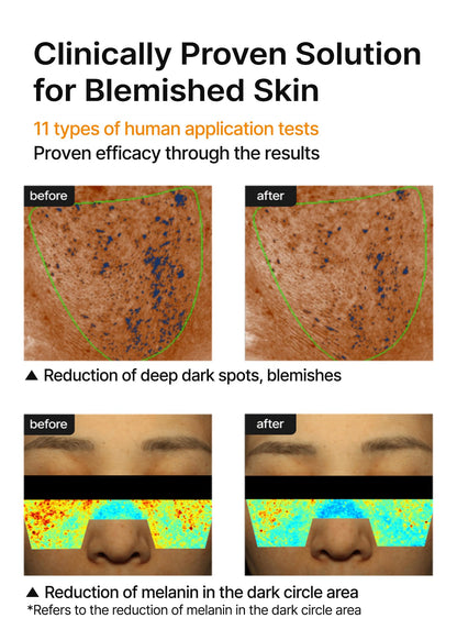 celimax Pore+Dark Spot Brightening Cream | with Niacinamide, Tranexamic Acid, TXA Cream