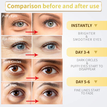 NAZANO 24K Gold Under Eye Patches - 60 Pack for Puffy Eyes, Dark Circles, Bags & Wrinkles