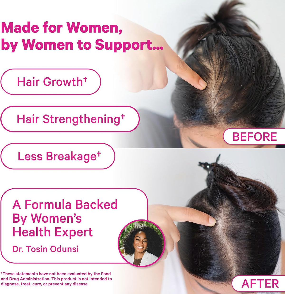 Pink Stork Postpartum Hair Loss Gummies, 60 Count | Biotin, Pantothenic Acid, Vitamin E, B6, B12, Breastfeeding-Friendly, Hair Growth + Regrowth Support