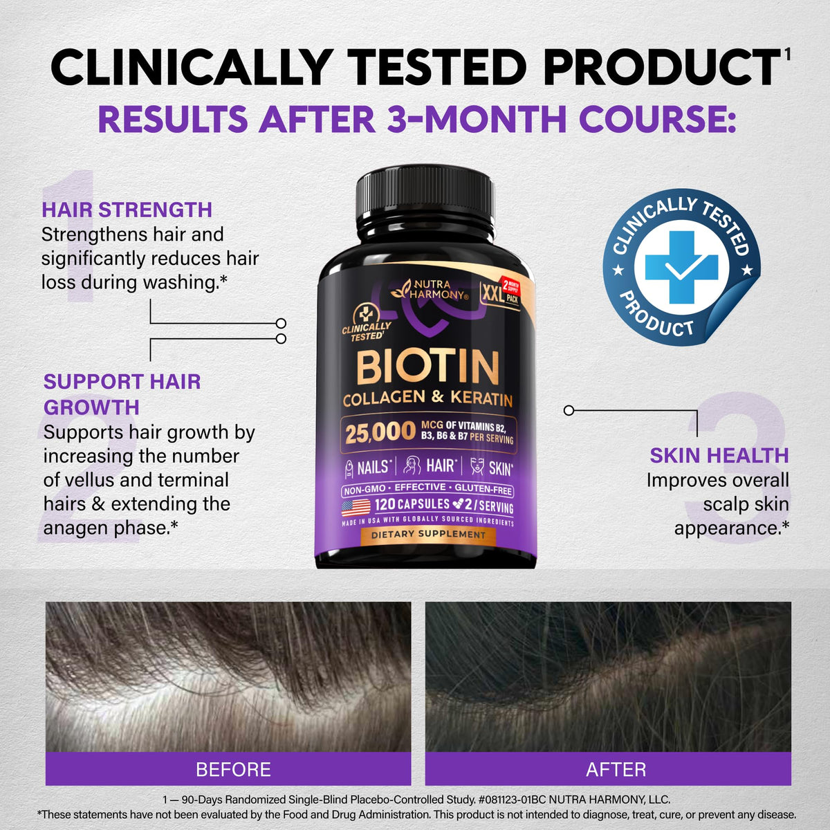 Biotin | Collagen | Hyaluronic Acid | Keratin - Hair Growth & Strength Support Vitamins - Skin & Nails Supplement - Clinically Tested for Men & Women - 25000mcg Vitamins B1, B2, B3, B6 & B7 - 60 Caps